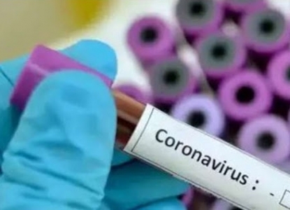 გასულ დღე-ღამეში კორონავირუსით გარდაიცვალა 34 ადამიანი